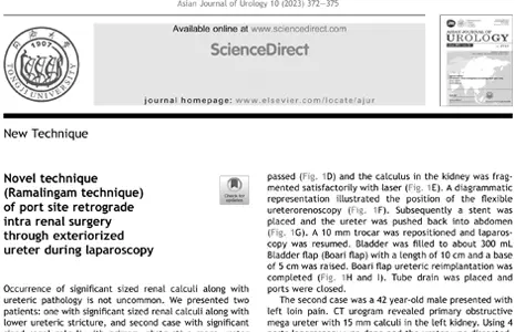Novel technique (Ramalingam technique) of port site retrograde intra renal surgery through exteriorized ureter during laparoscopy